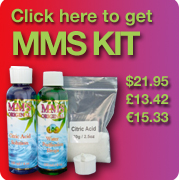 Buy MMS kit 